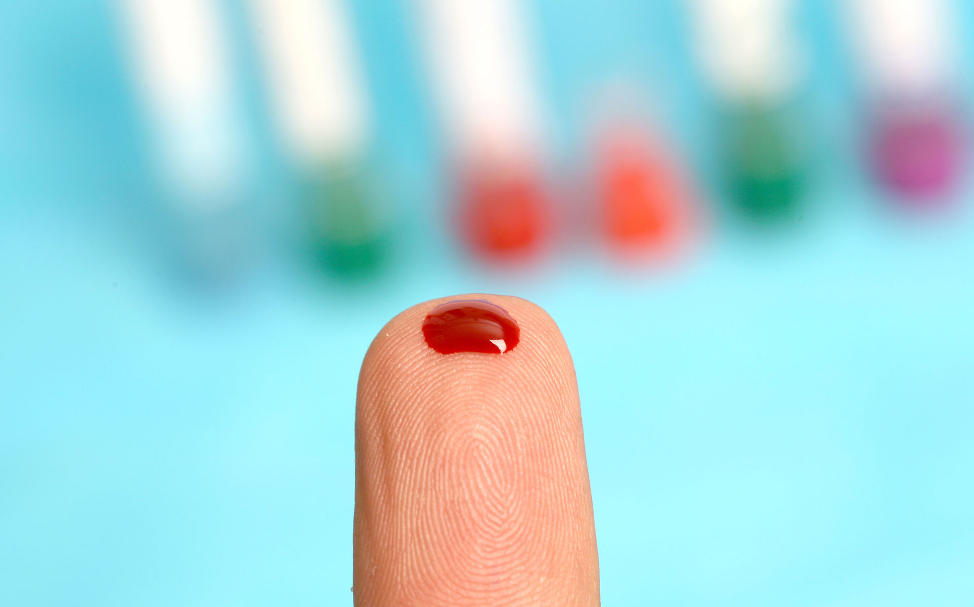 Inflammation als Risikofaktor - Laborleistungen