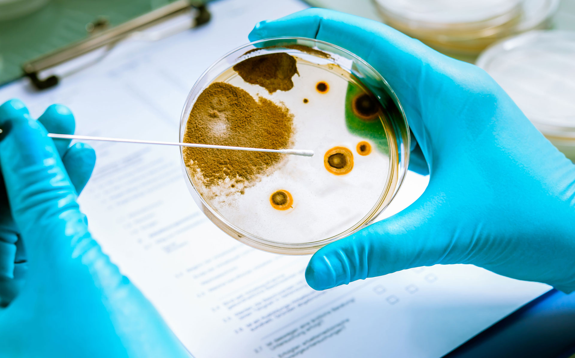 Mykologie - Spezielle Untersuchungen zum Nachweis von Pilzinfektionen