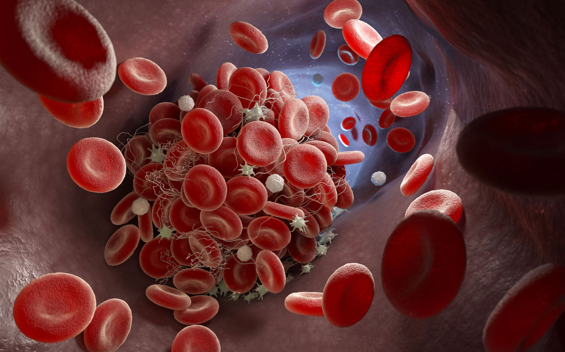 Thrombophilie-Diagnostik